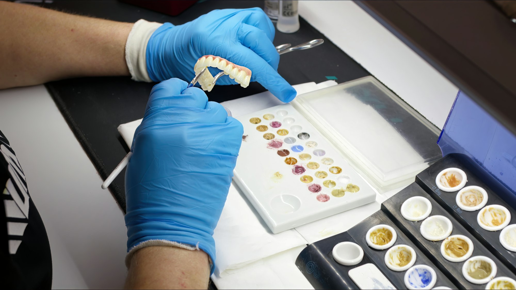 Zirconium porcelain and implant studies in the Dental Laboratory